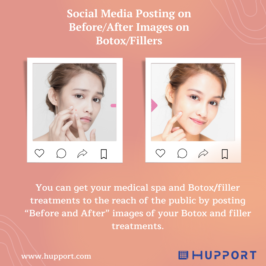 Social Media Posting on Before/After Images on Botox/Fillers